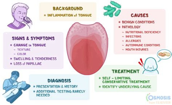 Understanding Briialexia: A Comprehensive Guide to Symptoms, Causes, and Treatment